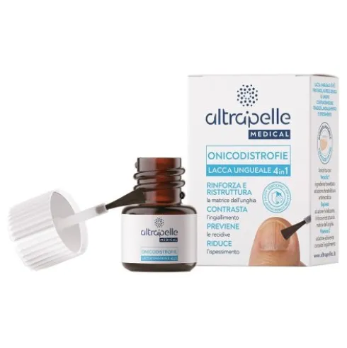 ALTRAPELLE ONICODISTROFIE