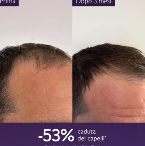 Caudalie Siero Capelli Anticaduta - Per la caduta dei capelli da stress, cambio di stagione o post-partum - 50 ml