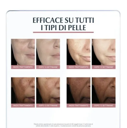 Eucerin Anti Pigment Giorno SPF30 - Crema viso antimacchie con fattore di protezione solare - 50 ml