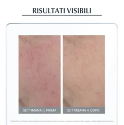 Eucerin Antirose Trattamento Giorno Neutralizzante SPF25 - Crema giorno per rosacea e couperose - 50 ml