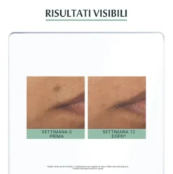 Eucerin Dermopurifyer Siero Tripla Azione - Siero anti macchie da acne, anti imperfezioni ed anti lucidità - 40 ml