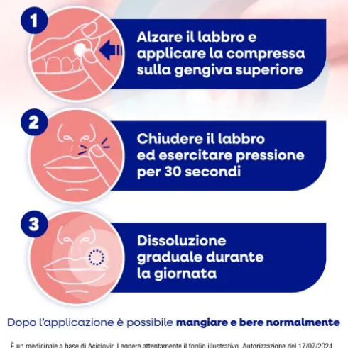Herpmed Labiale - Compresse buccali a base di Aciclovir per Herpes labiale - 2 compresse buccali mucoadesive