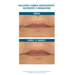 Miamo Hyalu-Repair Lip Balm - Balsamo labbra rimpolpante e nutriente - 15 ml - Aroma Frutti Tropicali - Limited Edition
