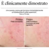 Neutrogena Hydro Boost Crema-Gel - Crema viso idratante per pelle secca e sensibile - 50 ml
