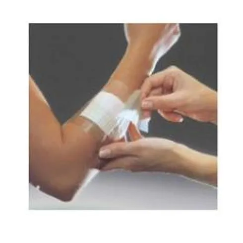 OPSITE FLEXIFIX 5cm x 10 mt 1pz