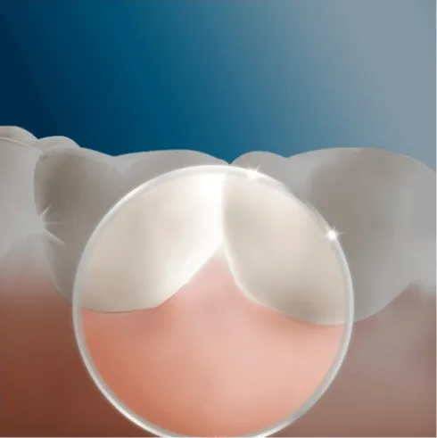 Oral-B Oxyjet MD20 Idropulsore Sistema Pulente con 4 Testine per Igiene Orale